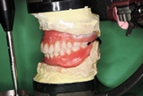 仮義歯