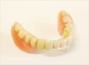 ドイツ式の高性能部分入れ歯 テレスコープ義歯