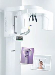 歯科用CTとセファロ、パノラマデジタルX-rayを精密検査機器として導入