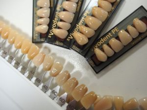 バラエティ豊かな色や形の人工歯で作る義歯