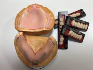 当院で行っているドイツ式の義歯（1）
