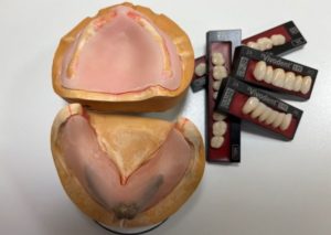 当院で行っているドイツ式の義歯の作製方法（1）