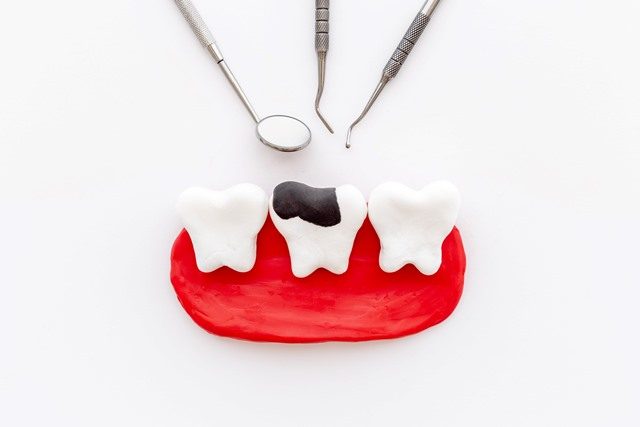 歯科イメージ