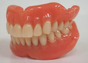 総義歯とレジリエンツテレスコープ義歯