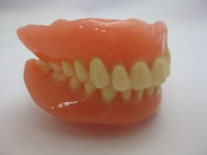 実際の治療例をご紹介（総入れ歯治療）