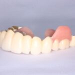 まだ、痛い入れ歯を我慢して使っていませんか?